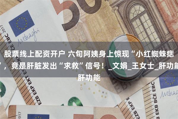 股票线上配资开户 六旬阿姨身上惊现“小红蜘蛛痣”，竟是肝脏发出“求救”信号！_文娟_王女士_肝功能